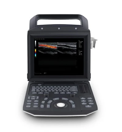 Ultrazvukový přenosný systém Zoncare M5 Color Doppler